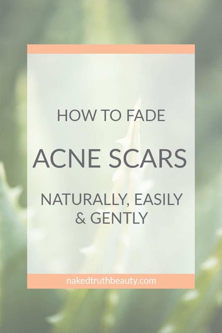 How to Fade Acne Scars Naturally, Easily, and Gently