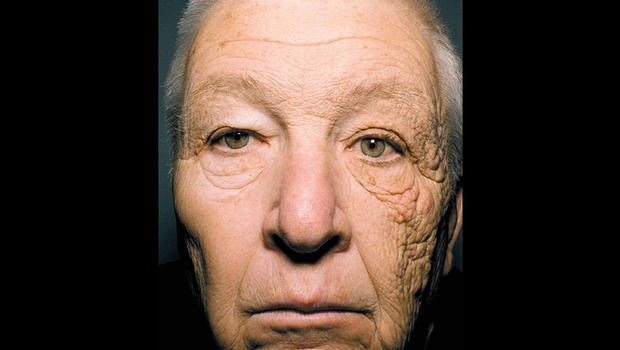How to Choose a Good Sunscreen, 28 years of truck driving skin damage